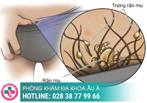 rận mu