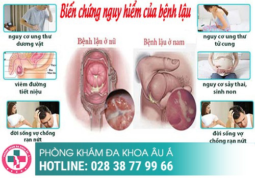 Bệnh lậu có nguy hiểm không?