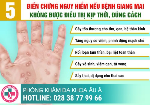 Những biểu hiện đáng sợ của bệnh giang mai giai đoạn cuối