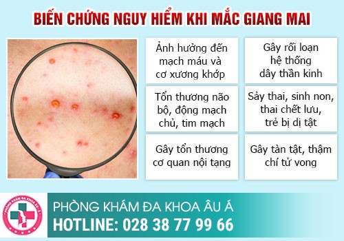 Cách nhận biết bệnh giang mai ở nữ qua từng giai đoạn