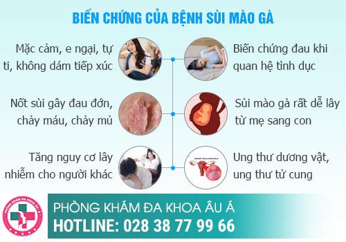 Sùi mào gà - căn bệnh dễ lây nhưng khó điều trị
