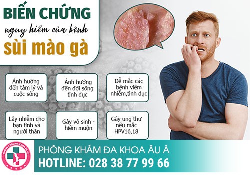 chữa sùi mào gà ở đâu