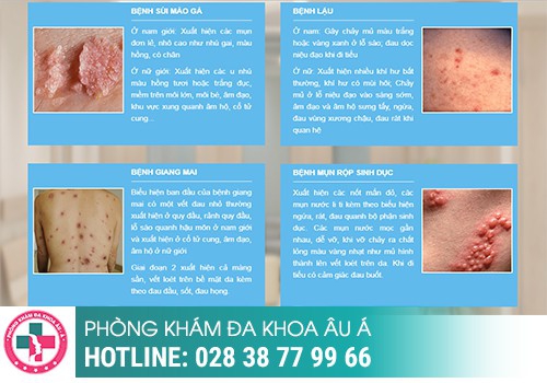 bệnh tình dục phổ biến thường gặp ở nam và nữ giới
