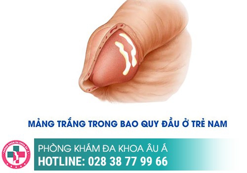 Một số hình ảnh bựa sinh dục ở nam thường gặp