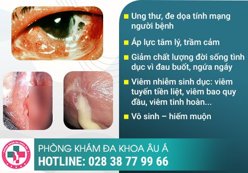 Ảnh hưởng của bệnh lậu đến sức khỏe