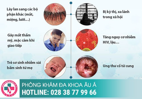 Mắc sùi mào gà ở bộ phận sinh dục có nguy hiểm không?