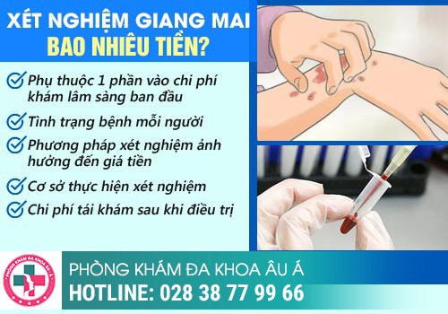 Xét nghiệm bệnh giang mai hết bao nhiêu?