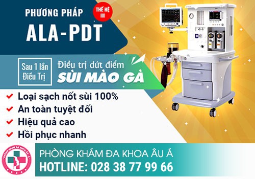 Cách điều trị sùi mào gà ở lưỡi an toàn và hiệu quả