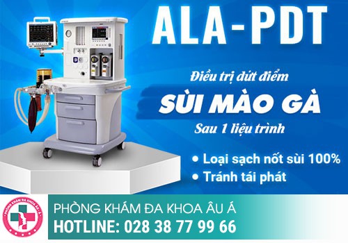 chữa sùi mào gà ở đâu