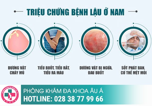 Bệnh lậu nam có thể gây vô sinh và nguy cơ tử vong cao