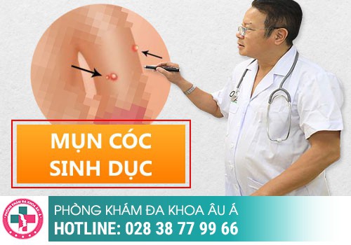 Bảng phân biệt sùi mào gà và mụn cóc