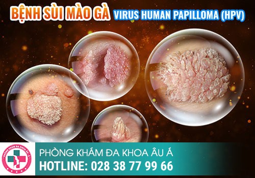 Nổi mụn trứng cá ở vùng kín nữ là bị bệnh gì?