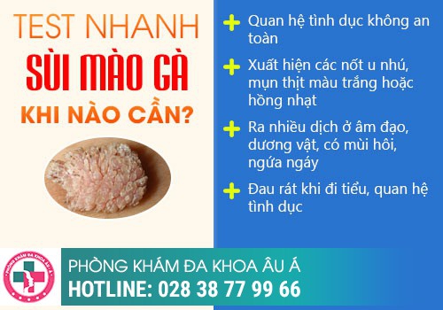 sùi mào gà ở nam giới