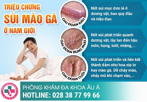 khám sùi mào gà ở đâu