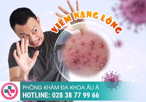 vùng kín mọc mụn