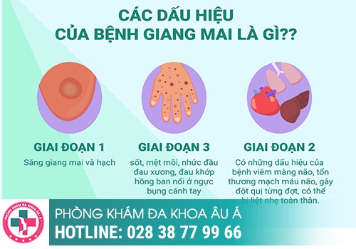 Cách nhận biết bệnh giang mai ở nữ qua từng giai đoạn