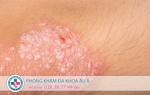 tong hop cac benh xa hoi hien nay