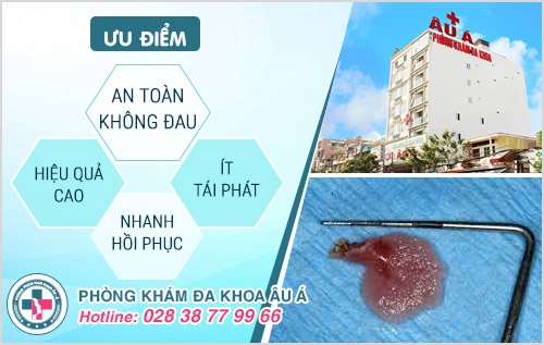 Chi tiết hình ảnh và biểu hiện sùi mào gà giai đoạn đầu