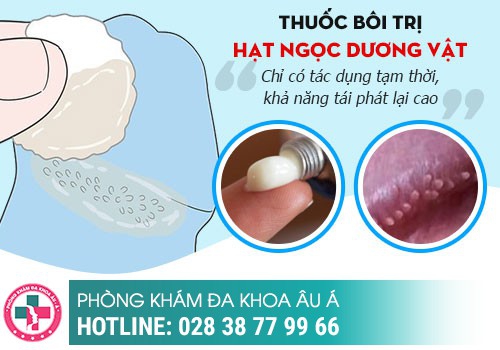 Những cách chữa chuỗi hạt ngọc dương vật tại nhà