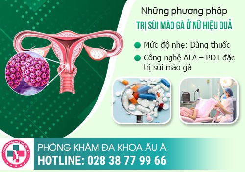 Sùi mào gà ở cổ tử cung – rất khó có thể nhận biết