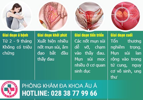 Các giai đoạn phát triển của sùi mào gà