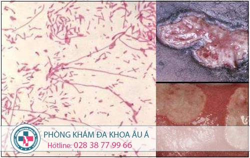 tong hop cac benh xa hoi hien nay