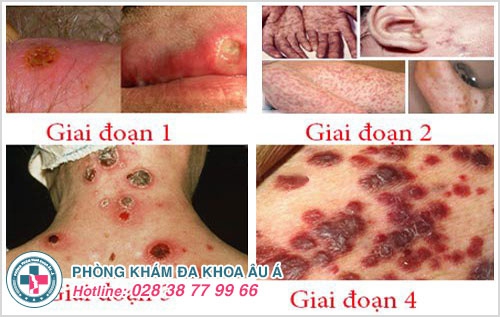 quan hệ tình dục không an toàn