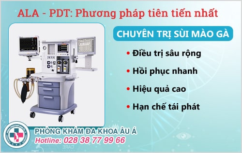 Hết lo lắng sùi mào gà ở họng nhờ phương pháp này