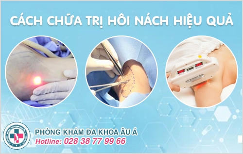Xấu hổ với bệnh hôi nách ở nam và nữ