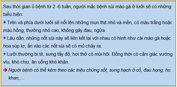 sùi mào gà ở lưỡi