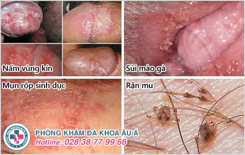 bệnh viện da liễu