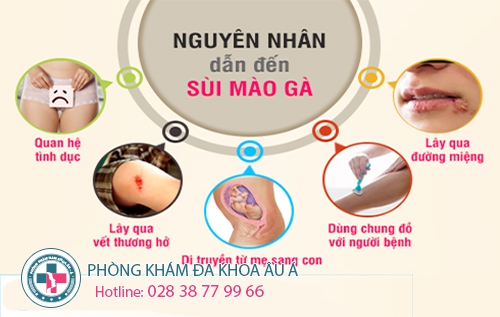 thong tin benh sui mao ga