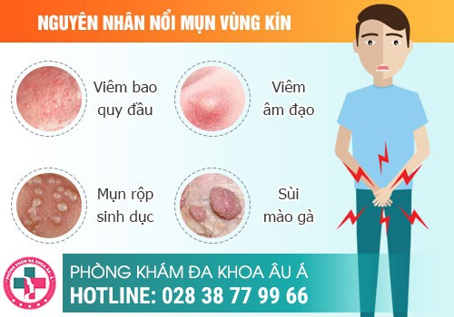 Nguyên nhân dương vật nổi mụn 
