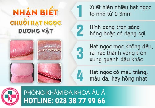 Chuỗi hạt ngọc quanh bao quy đầu là gì?