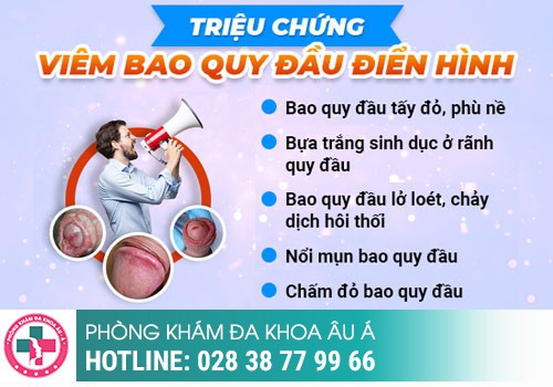 dương vật chảy mủ trắng đục
