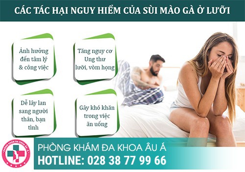 Một số hình ảnh sùi mào gà ở lưỡi