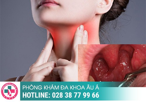 Hình ảnh sùi mào gà ở môi giai đoạn đầu