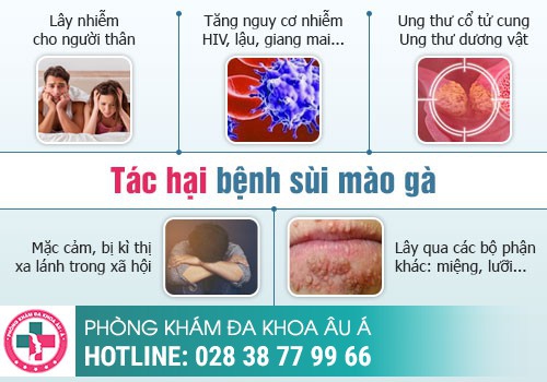 Bệnh sùi mào gà, căn bệnh dễ lây nhiễm nhưng khó điều trị