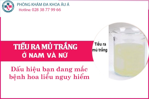 Tiểu Ra Mủ Trắng Có Phải Bệnh Lậu?