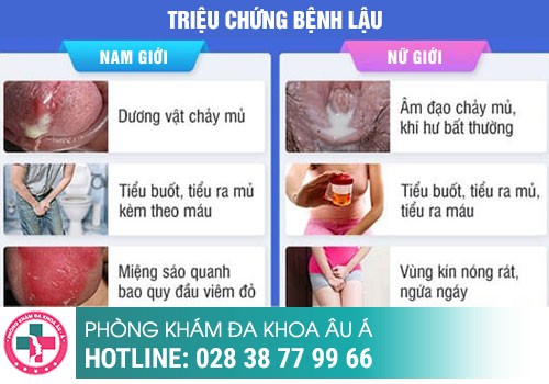 Tổng quan về bệnh lậu
