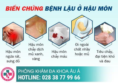Hình ảnh bệnh lậu mãn tính