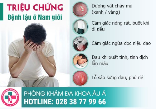 Nổi hạch dương vật là dấu hiệu bệnh gì?