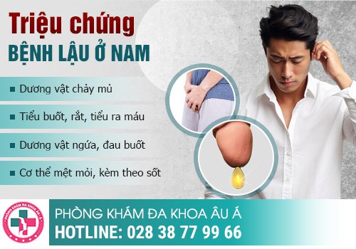 dấu hiệu bệnh lậu ở nam giới