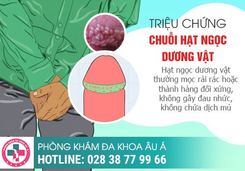 Hình ảnh hạt ngọc dương vật