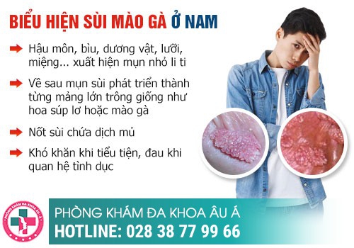 Sùi mào gà - căn bệnh dễ lây nhưng khó điều trị