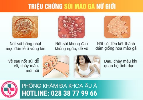 Cách nhận biết sùi mào gà ở âm đạo