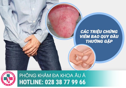 MỤN ĐẦU DƯƠNG VẬT