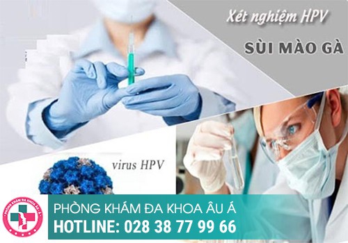 Vì sao cần xét nghiệm sùi mào gà?