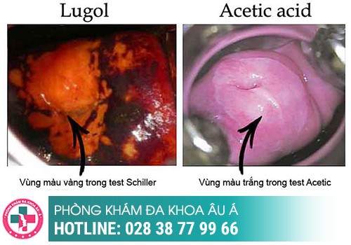 Xét nghiệm bệnh xã hội